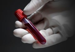 Анализ крови на герпес