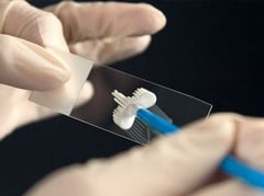 Анализ мазка шейки матки