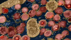 Возбудители хламидиоза - хламидии