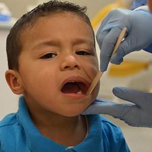 Язва на десне у ребенка