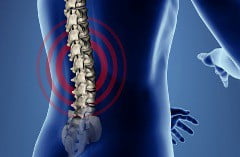 Часто ишиас проходит без применения лечения