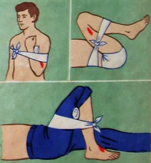 Первая помощь при кровотечении