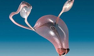 Метроэндометрит