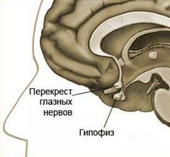 Микроаденома гипофиза