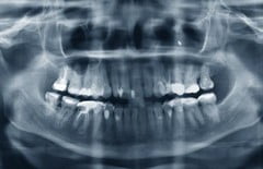 Магнитно-резонансная томография (МРТ) зубов Магнитно-резонансная томография (МРТ) зубов