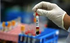 Диагностика нейтропении