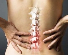Остеохондроз позвоночника