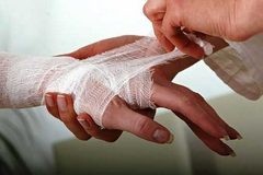 Лечение ожогов